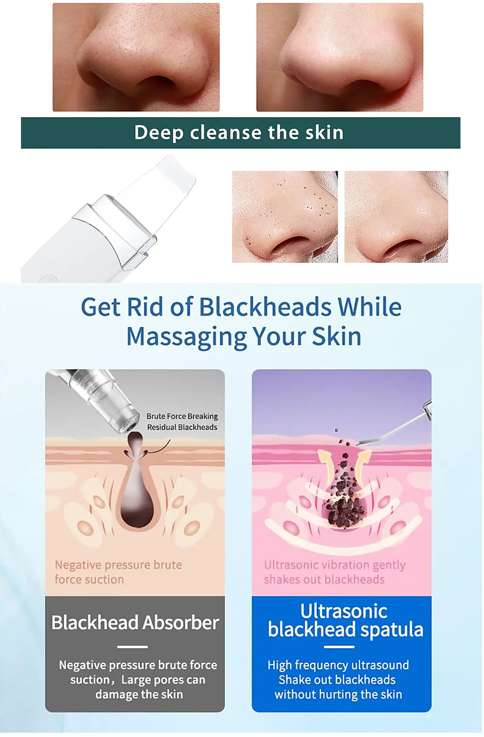 Agnès' Petit Paris Care Optimizers blackhead absorber and ultrasonic blackhead spatula for at home French skincare treatment