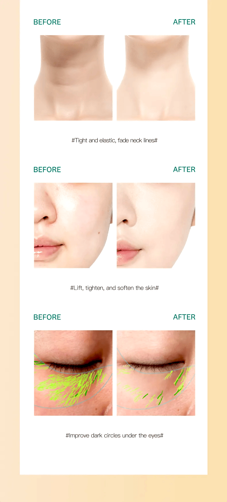 Before and after results showing tighter neck lines, lifted facial skin, and reduced dark circles using Delphy-triple head facial massager